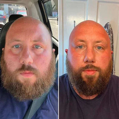 EYEPHALT - CREMA ANTI OJERAS Y BOLSAS - 49% OFF + ENVÍO GRATIS