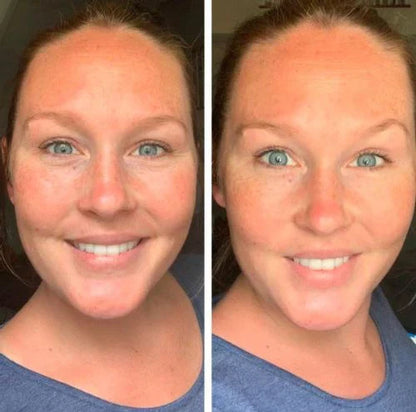 EYEPHALT - CREMA ANTI OJERAS Y BOLSAS - 49% OFF + ENVÍO GRATIS