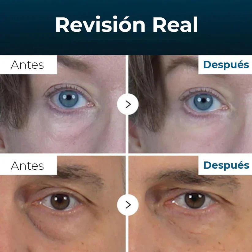 EYEPHALT - CREMA ANTI OJERAS Y BOLSAS - 49% OFF + ENVÍO GRATIS