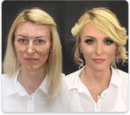 Base Vitaminc C Rejuvenescedora Hidratante Maquillaje