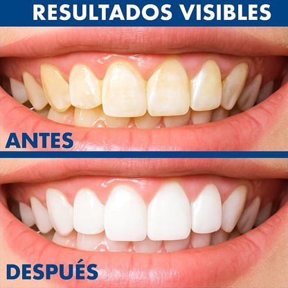 Dazzling White™ Pen – ¡Sonrisa blanca al instante, sin dentista!