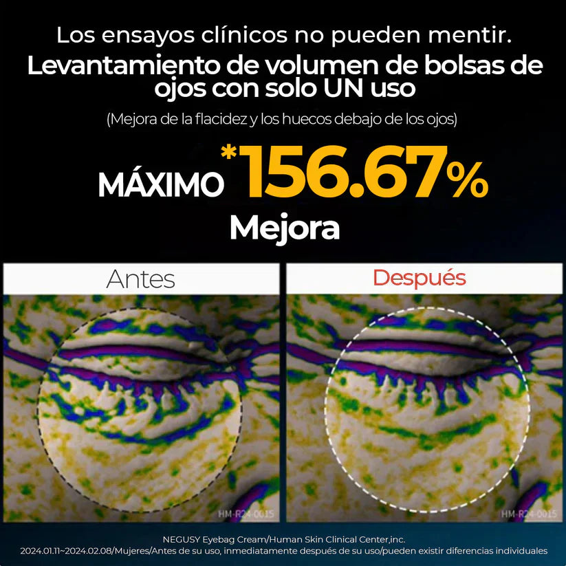 EYEPHALT - CREMA ANTI OJERAS Y BOLSAS - 49% OFF + ENVÍO GRATIS