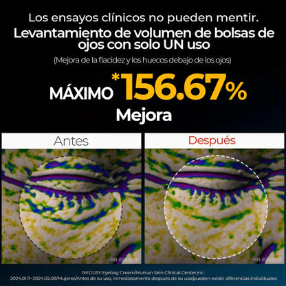 EYEPHALT - CREMA ANTI OJERAS Y BOLSAS - 49% OFF + ENVÍO GRATIS