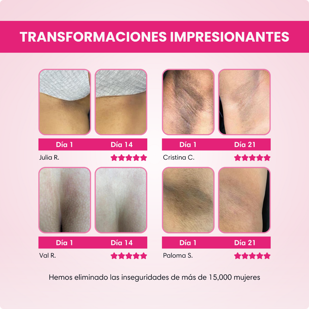 Crema Aclarante y Rejuvenescedor Skinglow