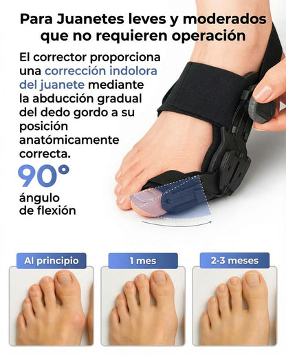 Corrector de Juanete con Perilla gradual ajustable